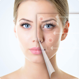 HASSASİYET GİDERİCİ