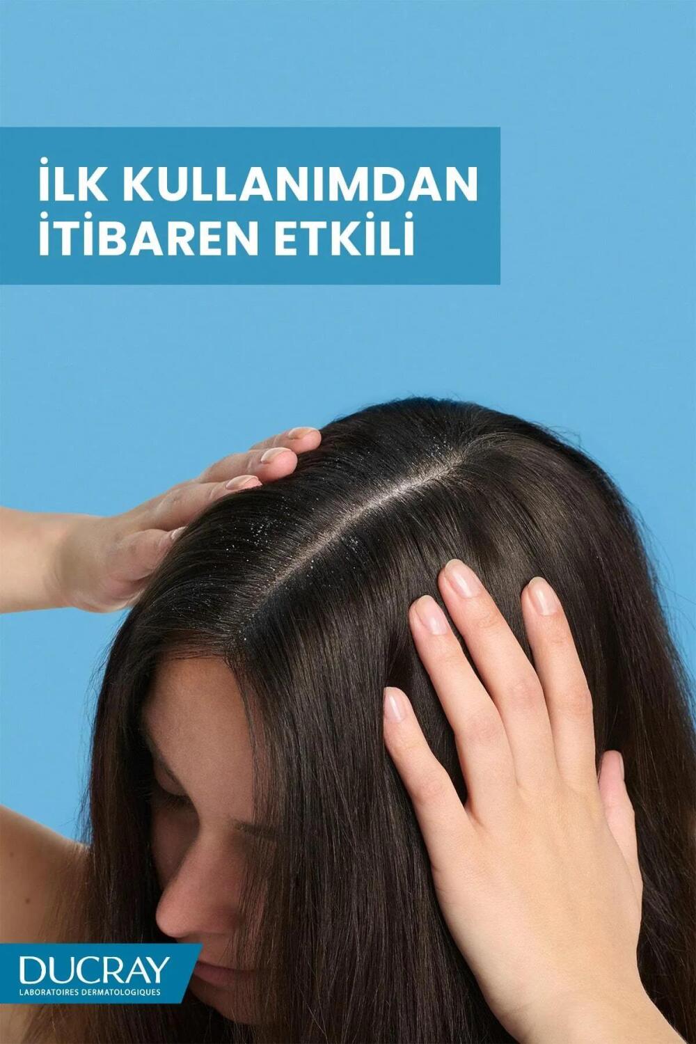 Ducray Kelual Squanorm Kuru Saçlar İçin Kepek Karşıtı Şampuan 400 ml - 5